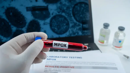 mpox-virus.jpg