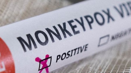 monkeypox-pakistan-latest