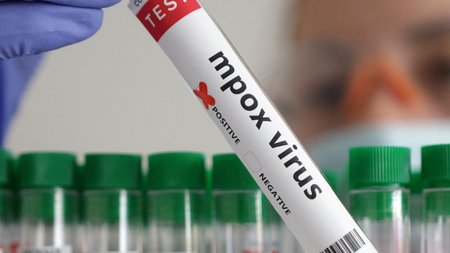 JZCZJSOI2JJDJK6VI3SHNHXJQE