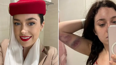 arthrou-aerosinodos (1)