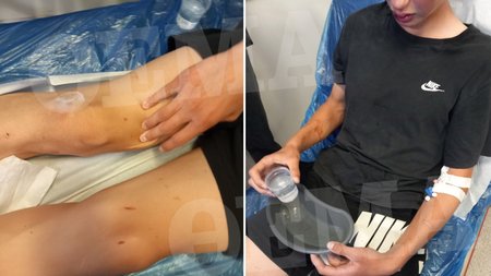 kalamata_ksylodarmos_xr