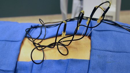 images_thermikh-neurolysh