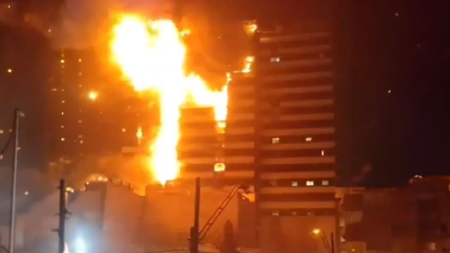 gandhi-hospital-arthrou